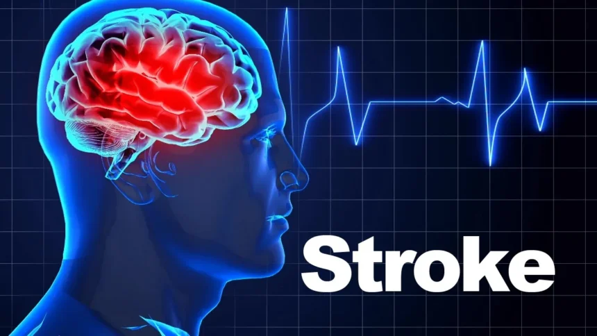 Laki-Laki Lebih Rentan Terkena Stroke: Fakta atau Mitos?