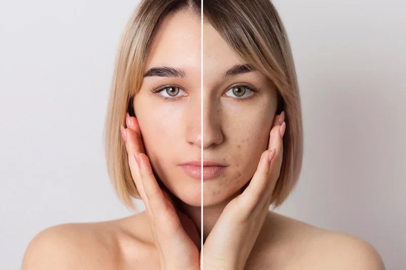 Bye-bye Flek Hitam! Skincare Routine Usia 30+ untuk Kulit Cerah Bebas Noda (Ilustrasi)