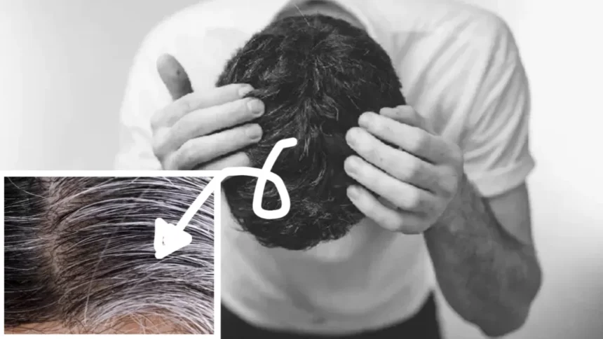 7 Efek Samping Mencabut Uban, Nomor tujuh Paling Sering Dilakukan “Stop Mulai Sekarang!”