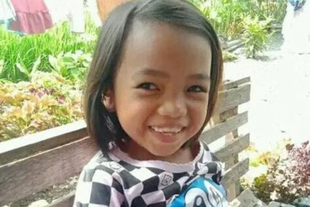 Kisah Pilu Aldelia: Tragedi Luka Bakar dan Pertarungan Hidup Seorang Anak