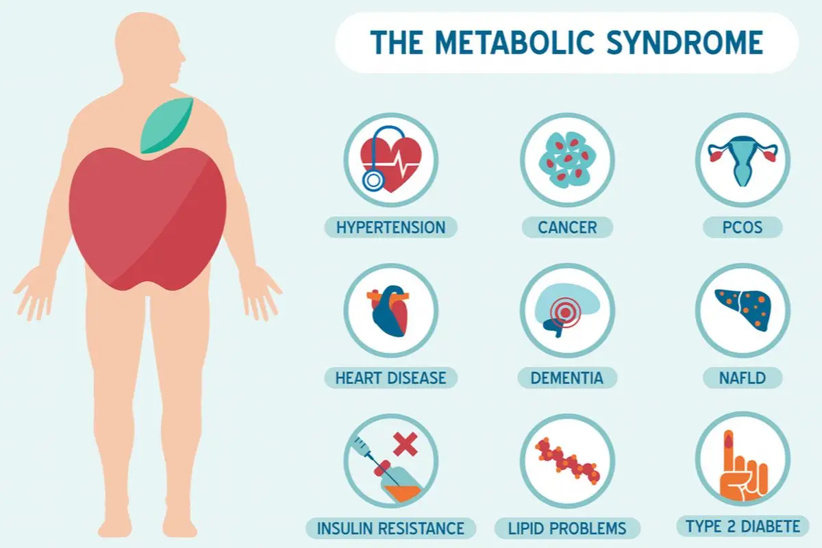 Apa Itu Sindrom Metabolik dan Bagaimana Cara Mencegahnya? Ini Penjelasannya! (Ilustrasi)